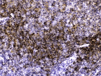 CD40 Antibody