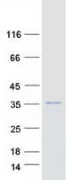 Human ARHGEF38 / FLJ20184 Protein (Recombinant Myc-DDK (Flag))