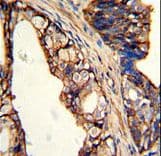 Polyclonal Rabbit anti-Human TGM4 / Transglutaminase 4 Antibody (aa135-164, IHC, WB)