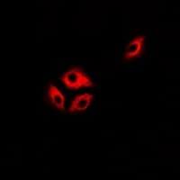 Polyclonal Rabbit anti-Human ASL / Argininosuccinate Lyase Antibody (IF, WB)