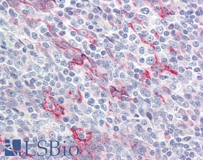 IHC-plus™ SPRR2A Antibody