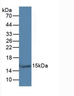 LGALS7 / Galectin 7 Antibody (aa1-136)