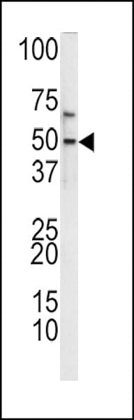 KLF11 Antibody (aa7-36)