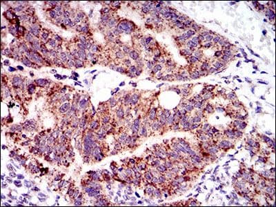 PTPN11 / SHP-2 / NS1 Antibody (Amino Acid: 263-329, clone 6D9)