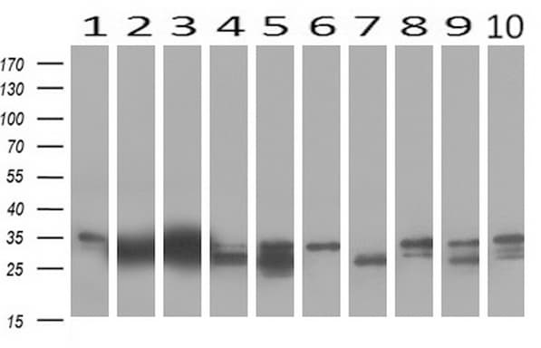 KLK8 / Kallikrein 8 Antibody (clone UMAB84, Carrier-free)