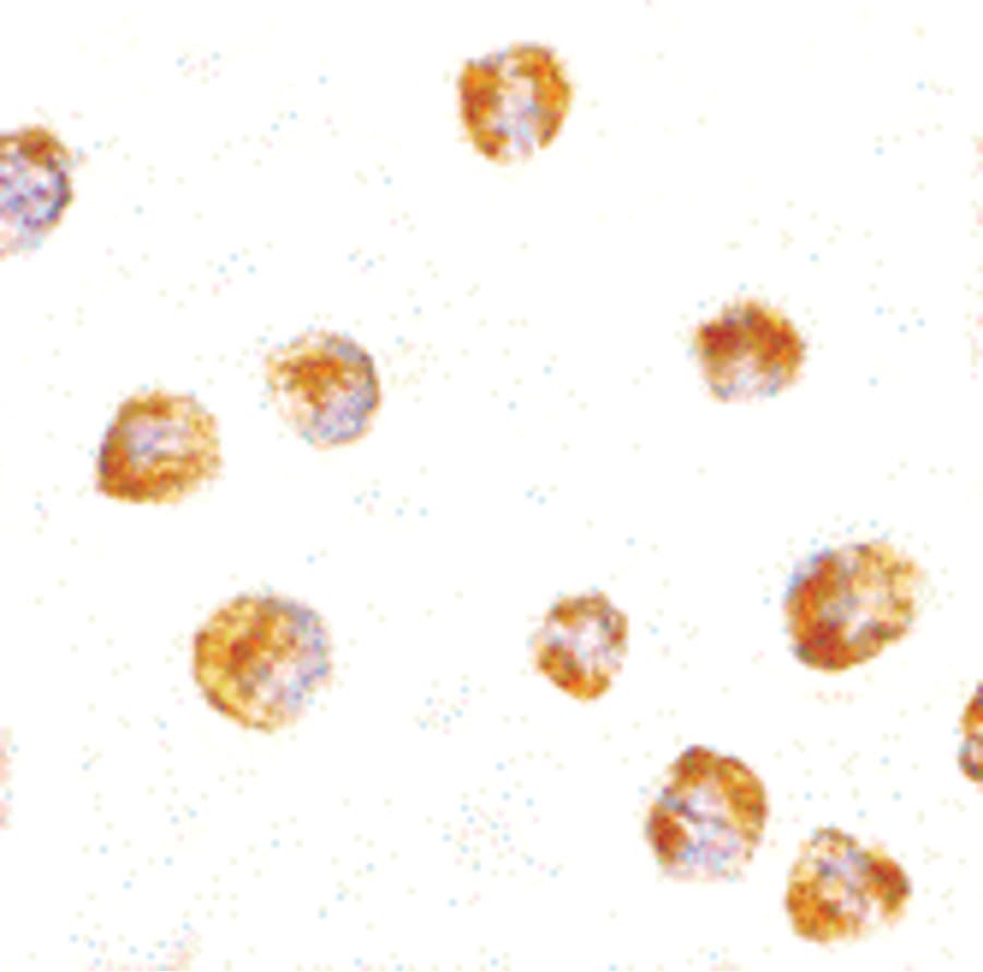 IHC-plus™ SUMO1 / SMT3 Antibody