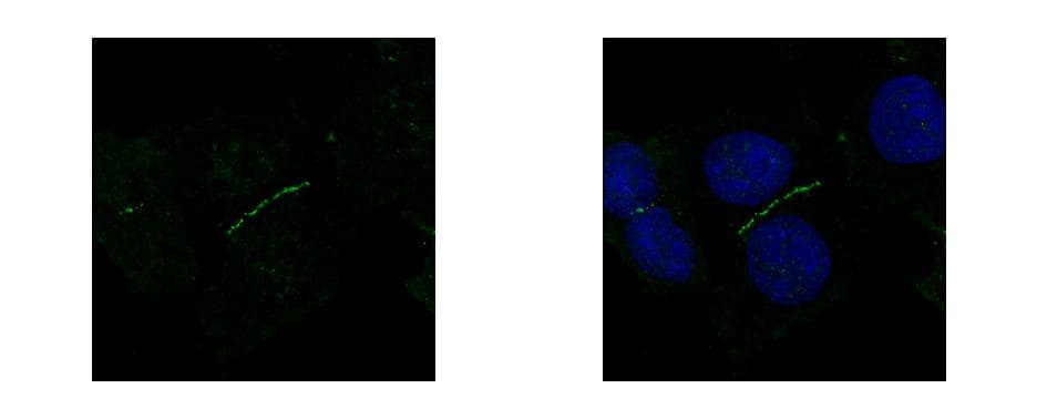 PathPlus™ TJP1 / ZO-1 Antibody (aa1-296)