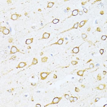 HSPA5 / GRP78 / BiP Antibody