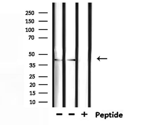 Polyclonal Rabbit anti-Human TSSK1B Antibody (WB)