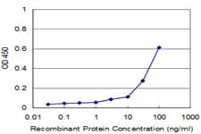 PIK3R1 / p85 Alpha Antibody (clone 3C11)