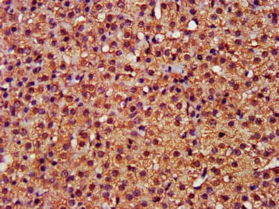 Polyclonal Rabbit anti-Human CFLAR / FLIP Antibody (IHC, WB)