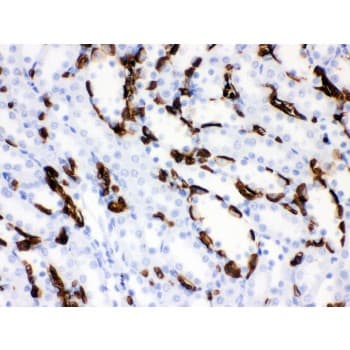 SLC4A1 / Band 3 / AE1 Antibody (aa28-365)