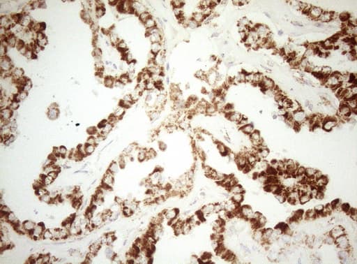 DECR1 Antibody (clone OTI5D12)