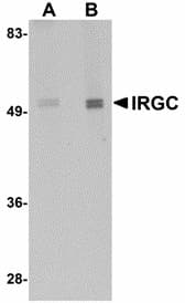 IHC-plus™ Polyclonal Rabbit anti-Human IRGC1 / CINEMA Antibody (IHC, IF, WB)