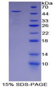 Rat ORM1 / Orosomucoid Protein (Recombinant His-GST)