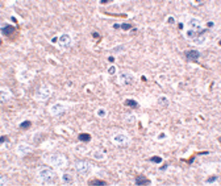 Monoclonal Mouse anti-Human PDCD1 / CD279 / PD-1 Antibody (clone 12A7D7, IHC, WB)