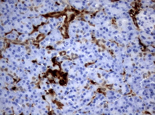 Monoclonal Mouse anti-Human TP / Thymidine Phosphorylase Antibody (clone UMAB90, Carrier-free, aa311-482, IHC, WB)