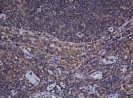 CRYAA / Alpha A Crystallin Antibody (clone OTI2C3)
