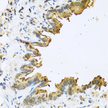DEFB4A / BD-2 Antibody