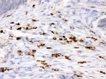 Polyclonal Rabbit anti-Human LYZ / Lysozyme Antibody (IHC, WB)