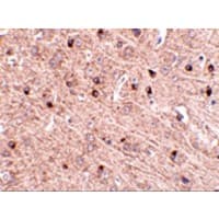Polyclonal Rabbit anti-Human TOMM70A Antibody (IHC, IF, WB)