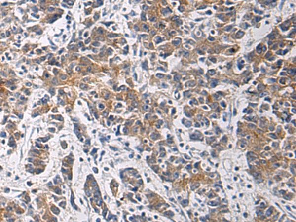 TMOD3 / Tropomodulin 3 Antibody