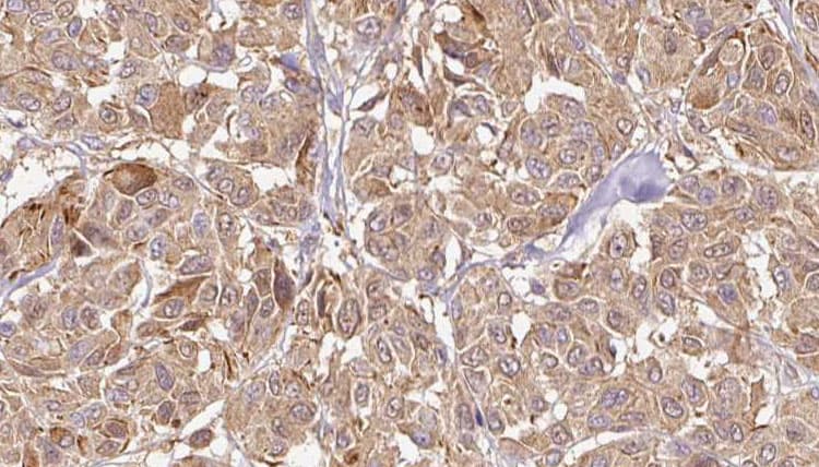 GPX5 Antibody
