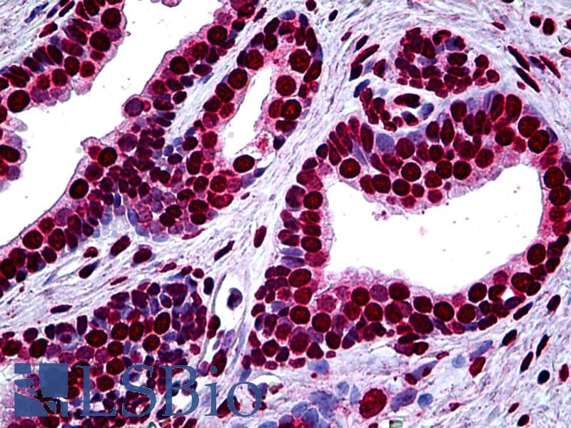 IHC-plus™ MEF2A / MEF2 Antibody (clone 1A10)