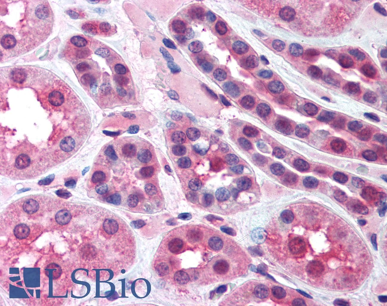 IHC-plus™ ERN1 / IRE1 Antibody (aa700-800)