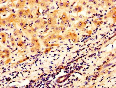 Polyclonal Rabbit anti-Human Osteoglycin / Mimecan Antibody (aa21-298)