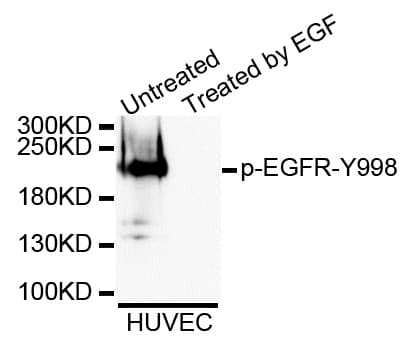 Polyclonal Rabbit anti-Human EGFR Antibody (phospho-Tyr998, WB)