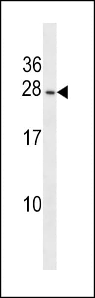 PIGP Antibody (aa2-30)