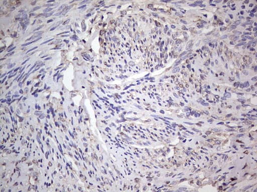 ER Alpha / Estrogen Receptor Antibody (aa1-310, clone OTI9E6)