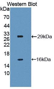 BIRC1 / NAIP Antibody (aa500-759)