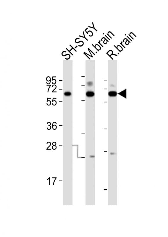 DPYSL5 / CRMP5 Antibody (aa478-512)