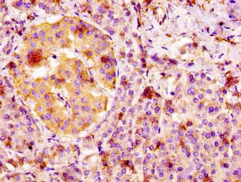 Polyclonal Rabbit anti-Human FGFR4 Antibody (IHC, IF)