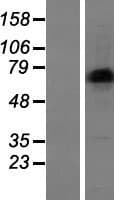 LIMD1 Protein (Over-Expression Lysate Myc-DDK (Flag))