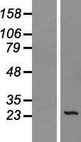 SEC22B Protein (Over-Expression Lysate Myc-DDK (Flag))