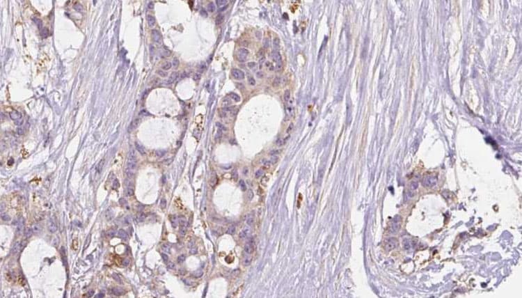 GRIN2B / NMDAR2B / NR2B Antibody (phospho-Tyr1474)