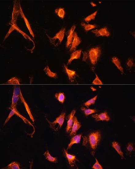 GFRA1 / GFR Alpha Antibody
