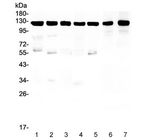 Beta Amyloid Antibody (aa672-702)