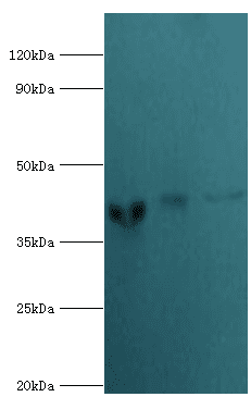 ACTR2 / ARP2 Antibody (aa1-160)