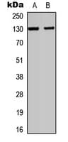ITGAE / CD103 Antibody (Internal)