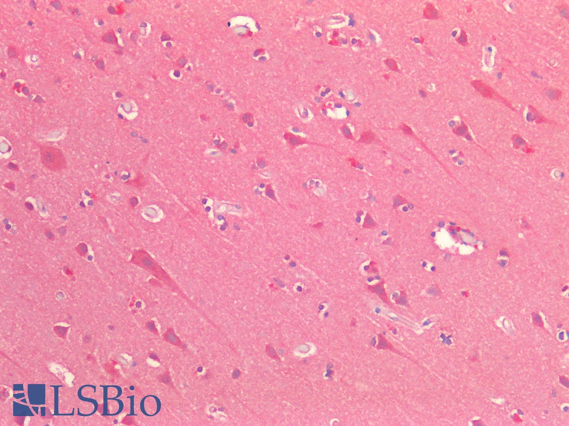 IHC-plus™ OSMR / IL-31R-Beta Antibody (clone 8F3H8B2)