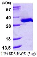 Human TRPT1 Protein (Recombinant His)
