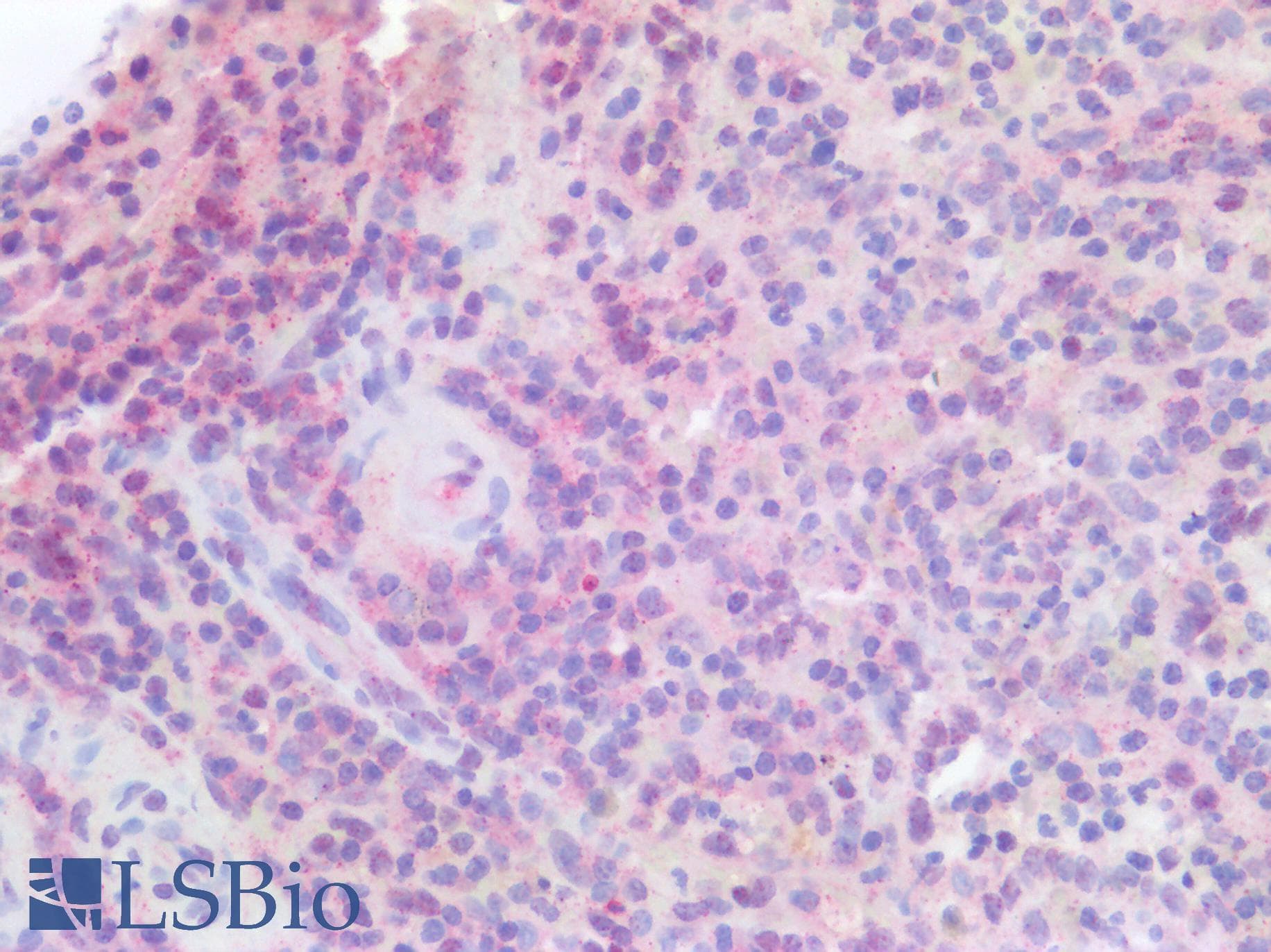 SMAD4 Antibody (clone RBT-SMAD4)