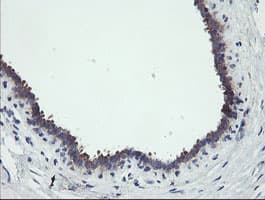 RIPK1 / RIP Antibody (aa133-422, clone OTI2D6, Carrier-free)