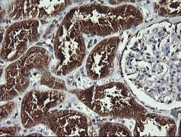 Monoclonal Mouse anti-Human ANAPC11 / APC11 Antibody (clone OTI1F2, IHC, WB)