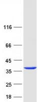 Human TPM4 Protein (Recombinant Myc-DDK (Flag))