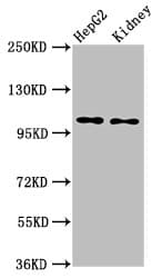 PC5 / PCSK5 Antibody